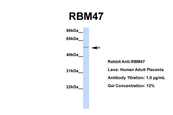Host: Rabbit Target Name: RBM47 Sample Tissue: Human Adult Placenta Antibody Dilution: 1.0ug/ml