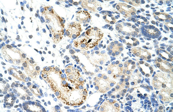 Rabbit Anti-NOC4L Antibody Catalog Number: ARP41005 Paraffin Embedded Tissue: Human Kidney Cellular Data: Epithelial cells of renal tubule Antibody Concentration: 4.0-8.0 ug/ml Magnification: 400X