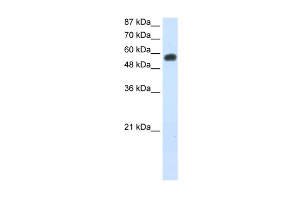 WB Suggested Anti-NOC4L Antibody Titration: 0.2-1 ug/ml Positive Control: Jurkat cell lysate