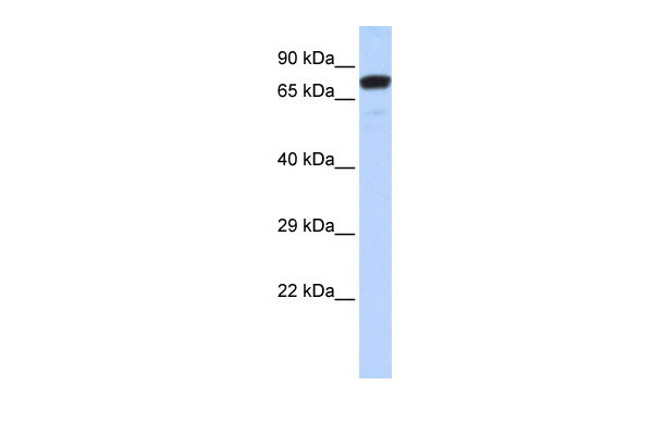 WB Suggested Anti-ZNF221 Antibody Titration: 0.2-1 ug/ml ELISA Titer: 1:312500 Positive Control: Hela cell lysate
