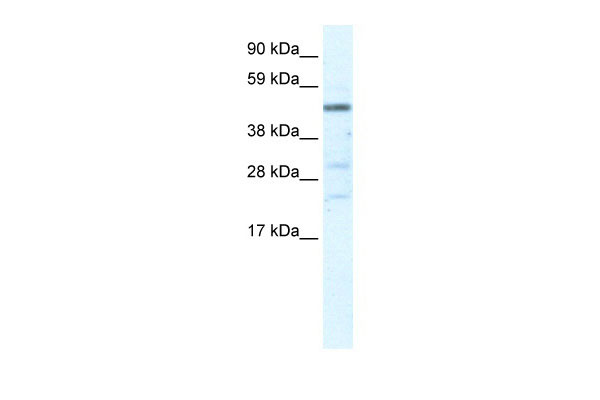 WB Suggested Anti-HSFY1 Antibody Titration: 5.0ug/ml ELISA Titer: 1:62500 Positive Control: Human Liver