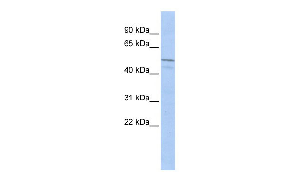 WB Suggested Anti-ZIM3 Antibody Titration: 0.2-1 ug/ml ELISA Titer: 1:312500 Positive Control: MCF7 cell lysate
