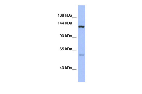 WB Suggested Anti-DHX34 Antibody Titration: 0.2-1 ug/ml ELISA Titer: 1:312500 Positive Control: THP-1 cell lysate