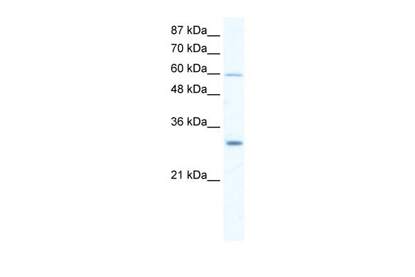 WB Suggested Anti-DDX31 Antibody Titration: 2.5ug/ml ELISA Titer: 1:1562500 Positive Control: Jurkat cell lysate