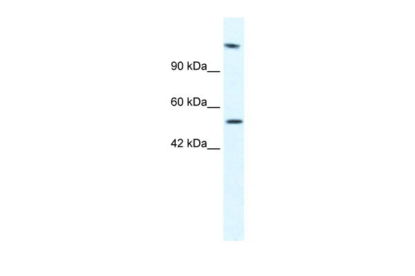 WB Suggested Anti-HELB Antibody Titration: 2.5ug/ml ELISA Titer: 1:62500 Positive Control: Jurkat cell lysate