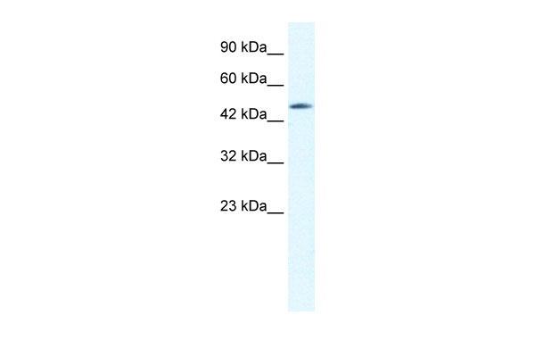 WB Suggested Anti-CX40.1 Antibody Titration: 0.6ug/ml ELISA Titer: 1:62500 Positive Control: HepG2 cell lysate