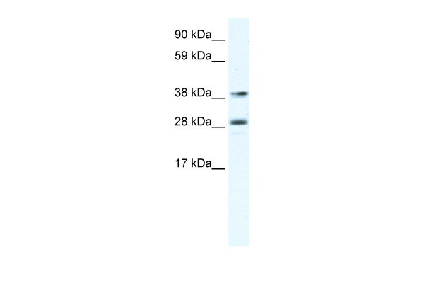 WB Suggested Anti-MEF2B Antibody Titration: 0.625ug/ml ELISA Titer: 1:312500 Positive Control: Human Lymphnode