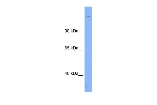 WB Suggested Anti-Sin3b Antibody Titration: 0.2-1 ug/ml ELISA Titer: 1:1562500 Positive Control: Human Thymus