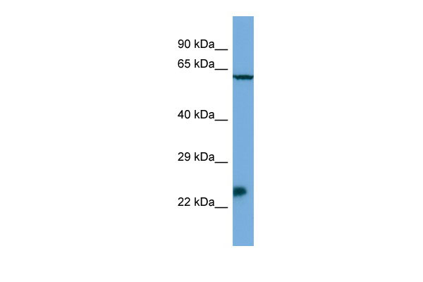 Host: Rabbit Target Name: Msx3 Sample Tissue: SP2/0 Whole Cell lysates Antibody Dilution: 1.0ug/ml