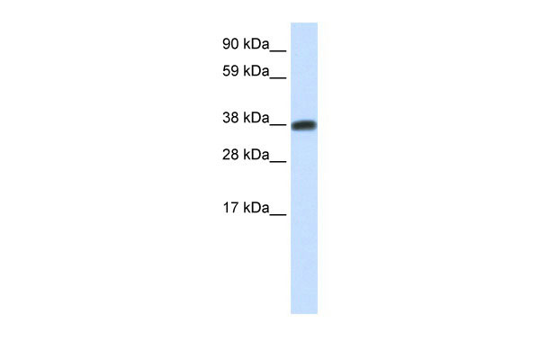 WB Suggested Anti-DMRTC2 Antibody Titration: 0.2-1 ug/ml ELISA Titer: 1:62500 Positive Control: Human Testis