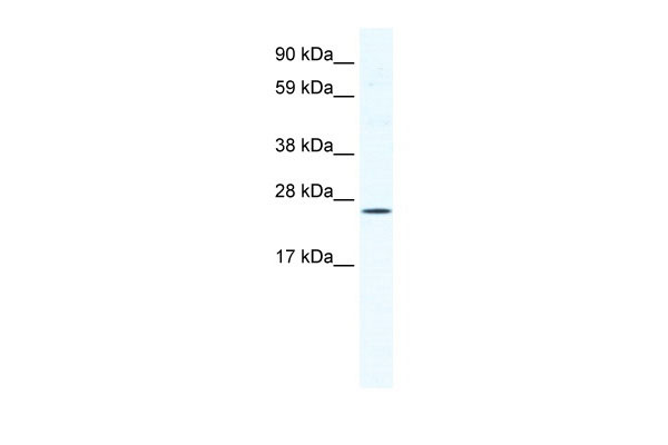 WB Suggested Anti-BRF1 Antibody Titration: 1.25ug/ml ELISA Titer: 1:62500 Positive Control: NIH/3T3 cell lysate