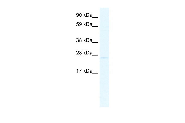 WB Suggested Anti-TCF23 Antibody Titration: 2.5ug/ml ELISA Titer: 1:62500 Positive Control: SP2/0 cell lysate