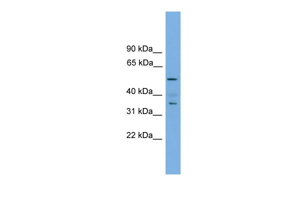 WB Suggested Anti-Nobox Antibody Titration: 0.2-1 ug/ml ELISA Titer: 1:312500 Positive Control: Mouse Muscle