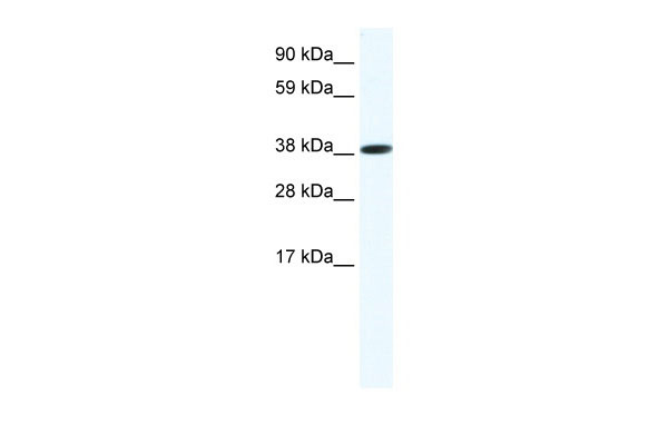 WB Suggested Anti-OBOX6 Antibody Titration: 1.25ug/ml ELISA Titer: 1:1562500 Positive Control: SP2/0 cell lysate