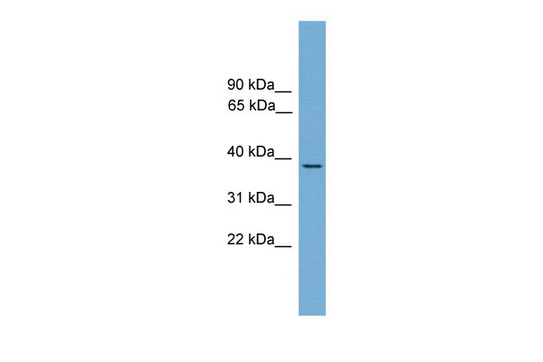 WB Suggested Anti-B230358A15Rik Antibody Titration: 0.2-1 ug/ml ELISA Titer: 1:62500 Positive Control: Mouse liver