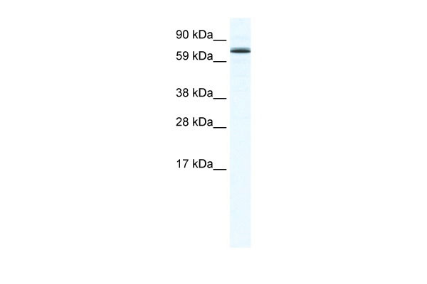 WB Suggested Anti-FOXO6 Antibody Titration: 1.25ug/ml ELISA Titer: 1:62500 Positive Control: SP2/0 cell lysate