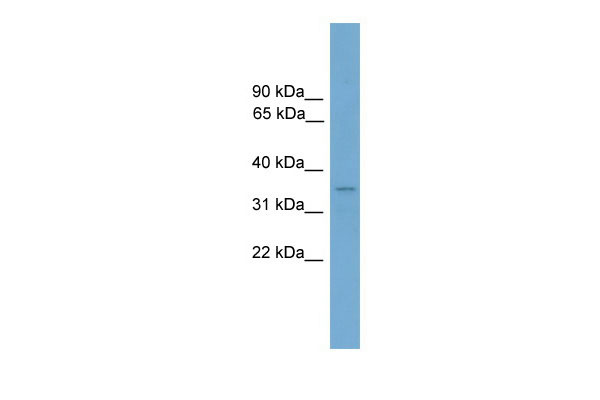 WB Suggested Anti-Duxbl Antibody Titration: 0.2-1 ug/ml Positive Control: Mouse Lung