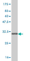 Antibody Reactive Against Recombinant Protein.Western Blot detection against Immunogen (31.24 KDa) . 