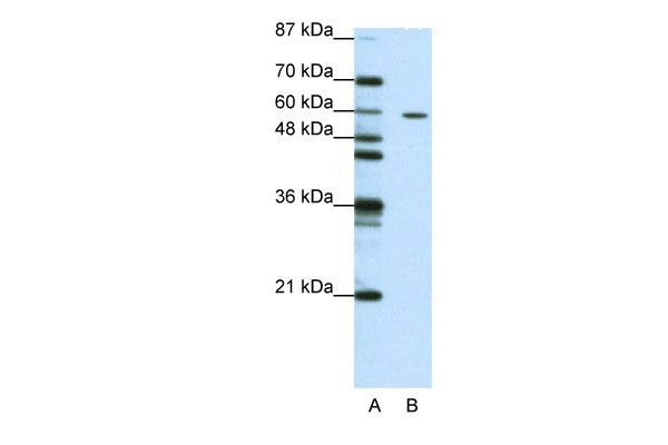 WB Suggested Anti-ZNF382 Antibody Titration: 1.25ug/ml ELISA Titer: 1:1562500 Positive Control: Jurkat cell lysate