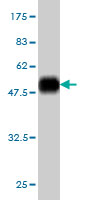 Antibody Reactive Against Recombinant Protein.Western Blot detection against Immunogen (52.47 KDa) . 