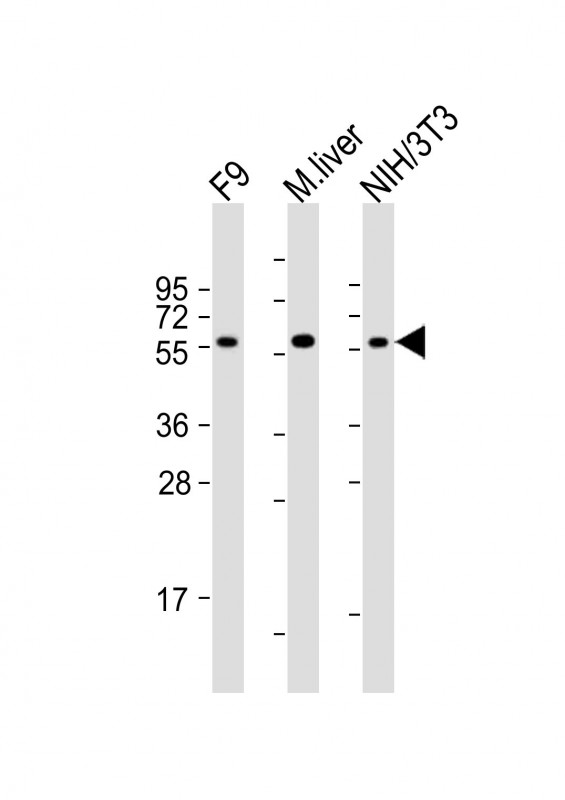 All lanes : Anti-Foxh1 Antibody (C-term) at 1:2000 dilution Lane 1: F9 whole cell lysates Lane 2: mouse liver lysates Lane 3: NIH/3T3 whole cell lysates Lysates/proteins at 20 µg per lane. Secondary Goat Anti-Rabbit IgG, (H+L), Peroxidase conjugated at 1/10000 dilution Predicted band size : 44 kDa Blocking/Dilution buffer: 5% NFDM/TBST.
