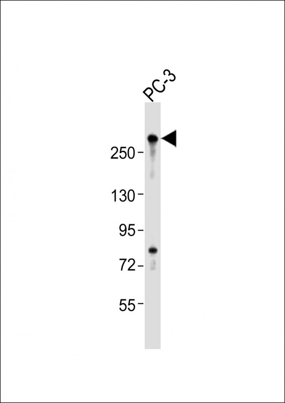 Anti-RLF Antibody (C-Term)at 1:2000 dilution + PC-3 whole cell lysates Lysates/proteins at 20 µg per lane. Secondary Goat Anti-Rabbit IgG, (H+L), Peroxidase conjugated at 1/10000 dilution Predicted band size : 218 kDa Blocking/Dilution buffer: 5% NFDM/TBST.