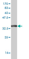 Antibody Reactive Against Recombinant Protein.Western Blot detection against Immunogen (34.21 KDa) . 