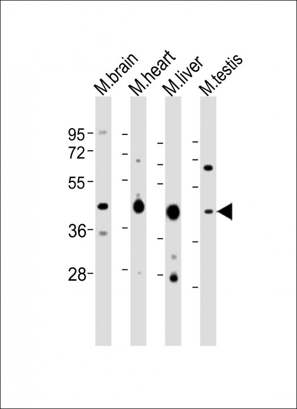 All lanes : Anti-Utf1 Antibody (C-term) at 1:2000 dilution Lane 1: mouse brain lysates Lane 2: mouse heart lysates Lane 3: mouse liver lysates Lane 4: mouse testis lysates Lysates/proteins at 20 µg per lane. Secondary Goat Anti-Rabbit IgG, (H+L), Peroxidase conjugated at 1/10000 dilution. Predicted band size : 36 kDa Blocking/Dilution buffer: 5% NFDM/TBST.