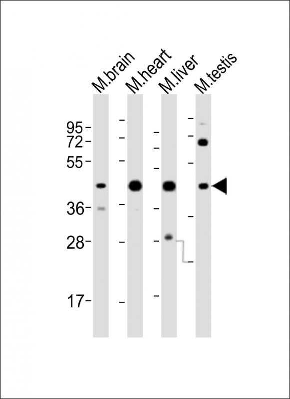 All lanes : Anti-Utf1 Antibody (C-term) at 1:2000 dilution Lane 1: mouse brain lysates Lane 2: mouse heart lysates Lane 3: mouse liver lysates Lane 4: mouse testis lysates Lysates/proteins at 20 µg per lane. Secondary Goat Anti-Rabbit IgG, (H+L), Peroxidase conjugated at 1/10000 dilution. Predicted band size : 36 kDa. Blocking/Dilution buffer: 5% NFDM/TBST.