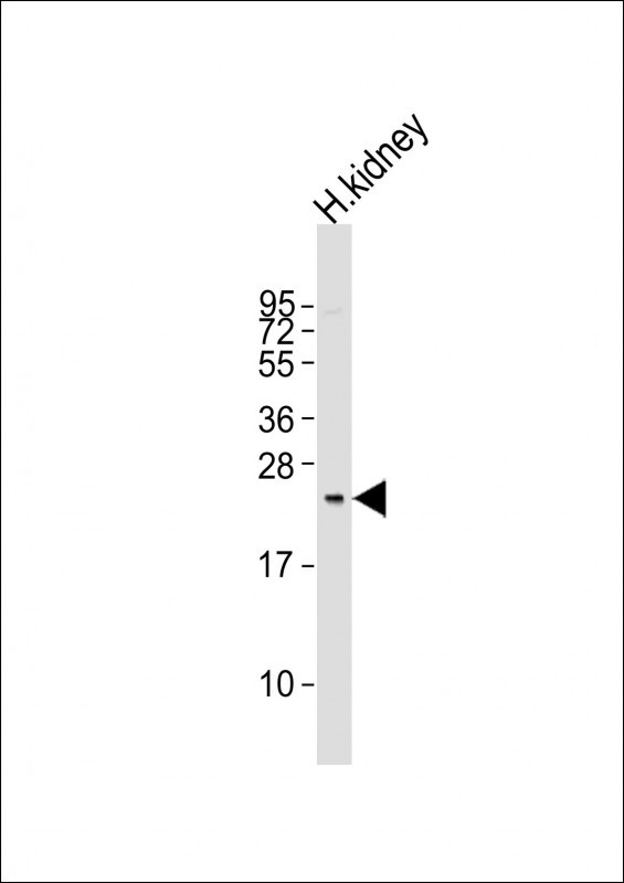 Anti-REG3G Antibody (Center)at 1:1000 dilution + human kidney lysates Lysates/proteins at 20 µg per lane. Secondary Goat Anti-Rabbit IgG, (H+L), Peroxidase conjugated at 1/10000 dilution. Predicted band size : 19 kDa Blocking/Dilution buffer: 5% NFDM/TBST.