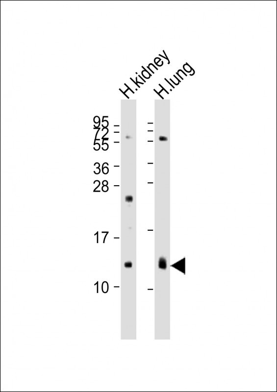 All lanes : Anti-REG3G Antibody (Center) at 1:2000 dilution Lane 1: human kidney lysates Lane 2: human lung lysates Lysates/proteins at 20 µg per lane. Secondary Goat Anti-Rabbit IgG, (H+L), Peroxidase conjugated at 1/10000 dilution. Predicted band size : 19 kDa Blocking/Dilution buffer: 5% NFDM/TBST.