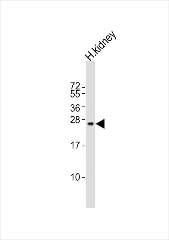 Anti-REG3G Antibody (Center)at 1:400 dilution + human kidney lysates Lysates/proteins at 20 µg per lane. Secondary Goat Anti-Rabbit IgG, (H+L), Peroxidase conjugated at 1/10000 dilution Predicted band size : 19 kDa Blocking/Dilution buffer: 5% NFDM/TBST.