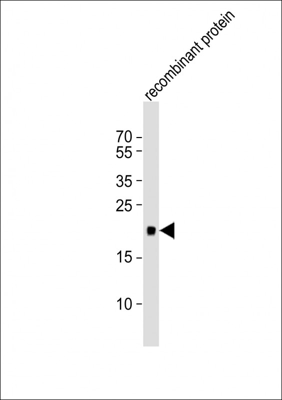 Anti-REG3G Antibody (Center)at 1:1000 dilution + recombinant protein lysates Lysates/proteins at 20 µg per lane. Secondary Goat Anti-Rabbit IgG, (H+L), Peroxidase conjugated at 1/10000 dilution Predicted band size : 19 kDa Blocking/Dilution buffer: 5% NFDM/TBST.