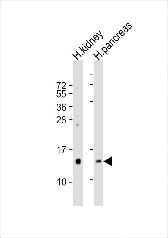 All lanes : Anti-REG3G Antibody (Center) at 1:100 dilution Lane 1: human kidney lysates Lane 2: human pancreas lysates Lysates/proteins at 20 µg per lane. Secondary Goat Anti-Rabbit IgG, (H+L), Peroxidase conjugated at 1/10000 dilution Predicted band size : 19 kDa Blocking/Dilution buffer: 5% NFDM/TBST.