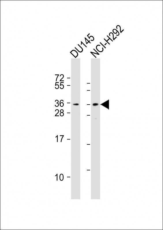 All lanes : Anti-TSPAN18 Antibody (Center) at 1:2000 dilution Lane 1: DU145 whole cell lysates Lane 2: NCI-H292 whole cell lysates Lysates/proteins at 20 µg per lane. Secondary Goat Anti-Rabbit IgG, (H+L), Peroxidase conjugated at 1/10000 dilution. Predicted band size : 28 kDa Blocking/Dilution buffer: 5% NFDM/TBST.
