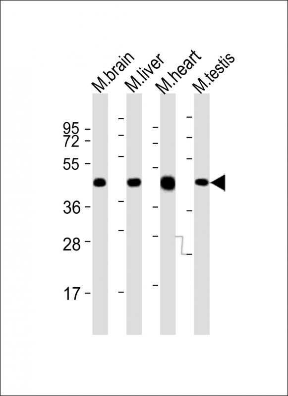 All lanes : Anti-Utf1 Antibody (C-term) at 1:2000 dilution Lane 1: mouse brain lysates Lane 2: mouse liver lysates Lane 3: mouse heart lysates Lane 4: mouse testis lysates Lysates/proteins at 20 µg per lane. Secondary Goat Anti-Rabbit IgG, (H+L), Peroxidase conjugated at 1/10000 dilution. Predicted band size : 36 kDa Blocking/Dilution buffer: 5% NFDM/TBST.
