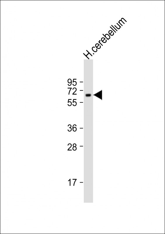 Anti-SPPL2B Antibody (Center)at 1:2000 dilution + human cerebellum lysates Lysates/proteins at 20 µg per lane. Secondary Goat Anti-Rabbit IgG, (H+L), Peroxidase conjugated at 1/10000 dilution. Predicted band size : 65 kDa Blocking/Dilution buffer: 5% NFDM/TBST.