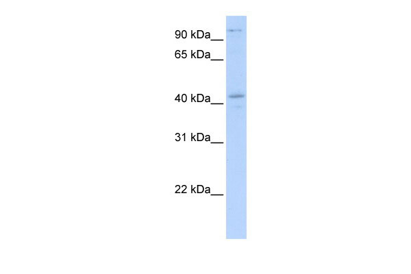 WB Suggested Anti-FGD1 Antibody Titration: 0.2-1 ug/ml ELISA Titer: 1:312500 Positive Control: Transfected 293T