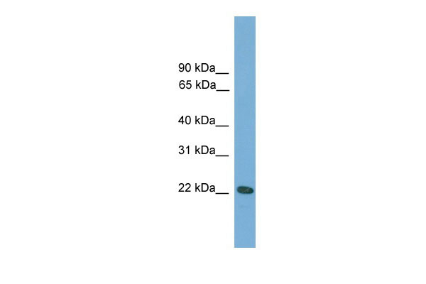WB Suggested Anti-Rgs1 Antibody Titration: 0.2-1 ug/ml ELISA Titer: 1:1562500 Positive Control: Mouse Uterus