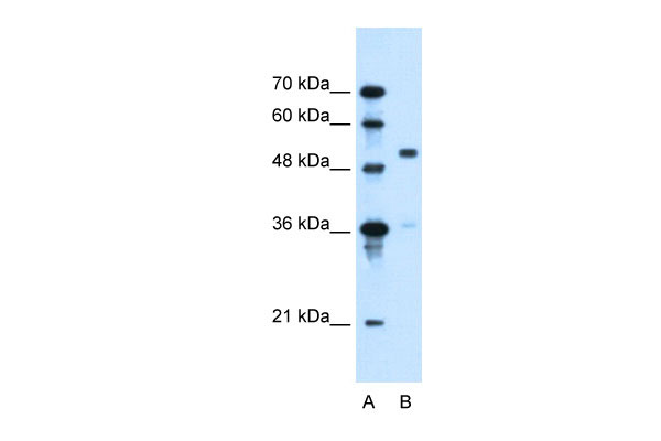 WB Suggested Anti-SLC37A3 Antibody Titration: 0.2-1 ug/ml Positive Control: HepG2 cell lysate