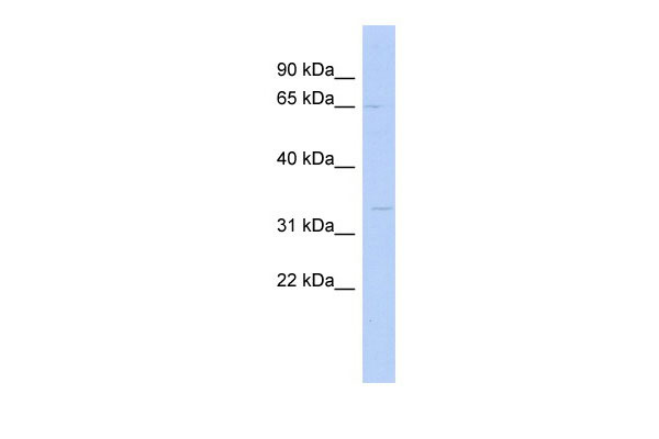 WB Suggested Anti-SC5DL Antibody Titration: 0.2-1 ug/ml ELISA Titer: 1:1562500 Positive Control: COLO205 cell lysate