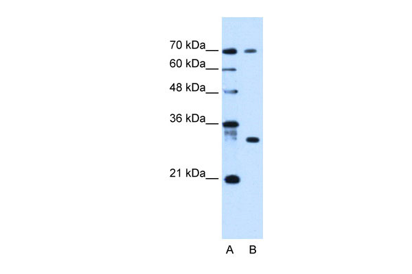 WB Suggested Anti-ATP6AP1L Antibody Titration: 0.2-1 ug/ml Positive Control: HepG2 cell lysate