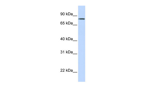 WB Suggested Anti-LST-3TM12 Antibody Titration: 0.2-1 ug/ml ELISA Titer: 1:1562500 Positive Control: Human Lung
