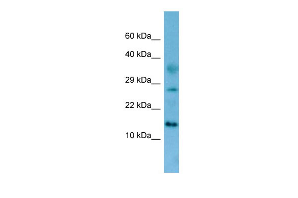 WB Suggested Anti-Fam19a4 Antibody Titration: 1.0 ug/ml Positive Control: Rat Kidney