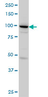 SH3D19 monoclonal antibody (M01), clone 5C7 Western Blot analysis of SH3D19 expression in HeLa ( (Cat # AT3872a )