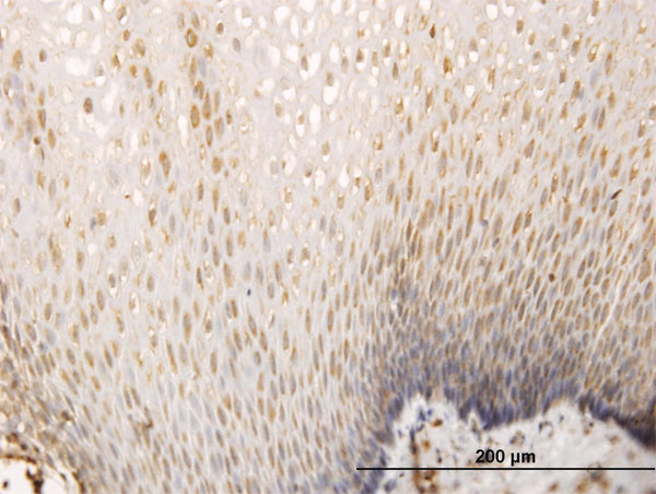 Immunoperoxidase of monoclonal antibody to SH3D19 on formalin-fixed paraffin-embedded human esophagus. [antibody concentration 3 ug/ml]