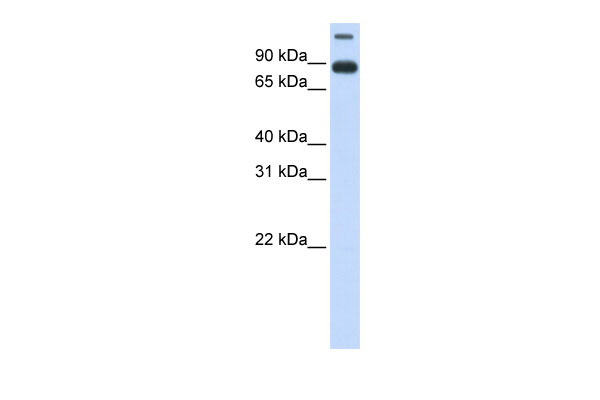 WB Suggested Anti-TMEM48 Antibody Titration: 0.2-1 ug/ml ELISA Titer: 1:62500 Positive Control: Human Lung