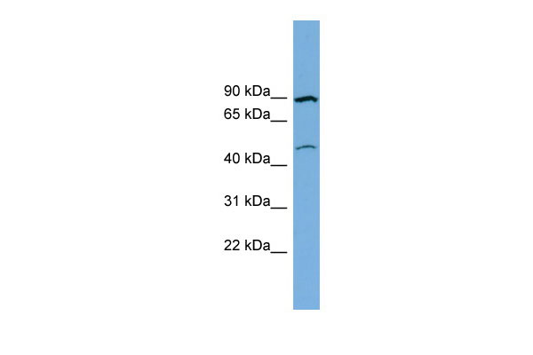 WB Suggested Anti-TMEM48 Antibody Titration: 0.2-1 ug/ml Positive Control: THP-1 cell lysate