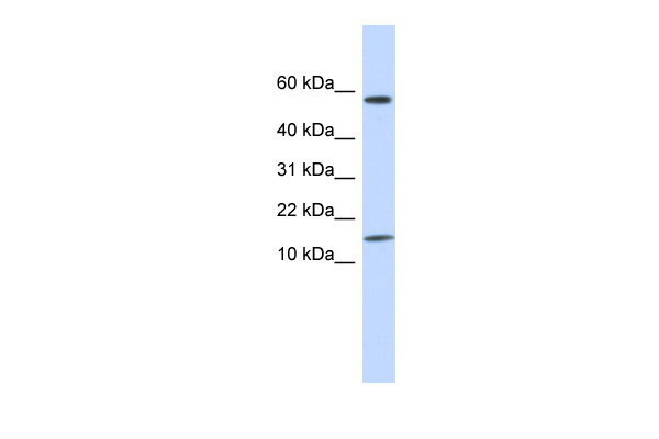 WB Suggested Anti-KRTAP11-1 Antibody Titration: 0.2-1 ug/ml ELISA Titer: 1:62500 Positive Control: Human Placenta