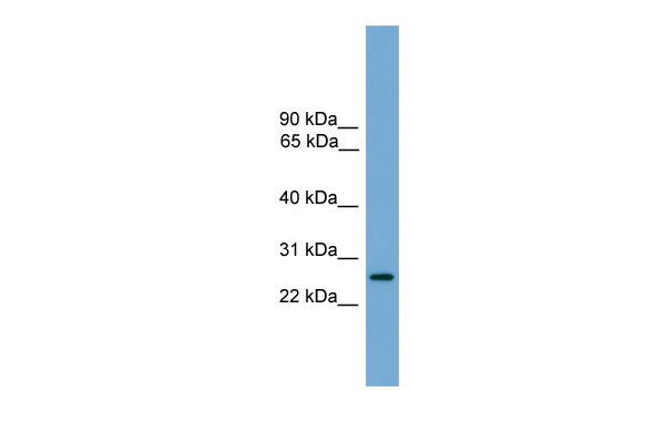 WB Suggested Anti-LRRC3 Antibody Titration: 0.2-1 ug/ml Positive Control: Human brain